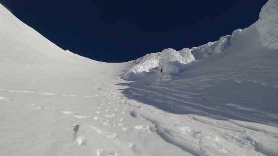 A review shot of the upper face/funnel. 